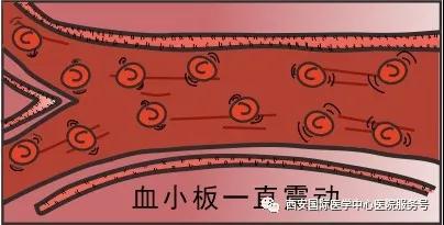 血小板是正常值的三倍？專(zhuān)家提醒小心血栓和出血！
