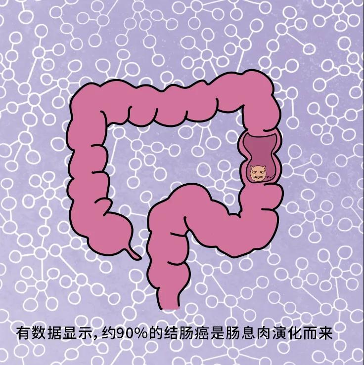奪走“黑豹”生命的結(jié)腸癌，到底什么來頭？