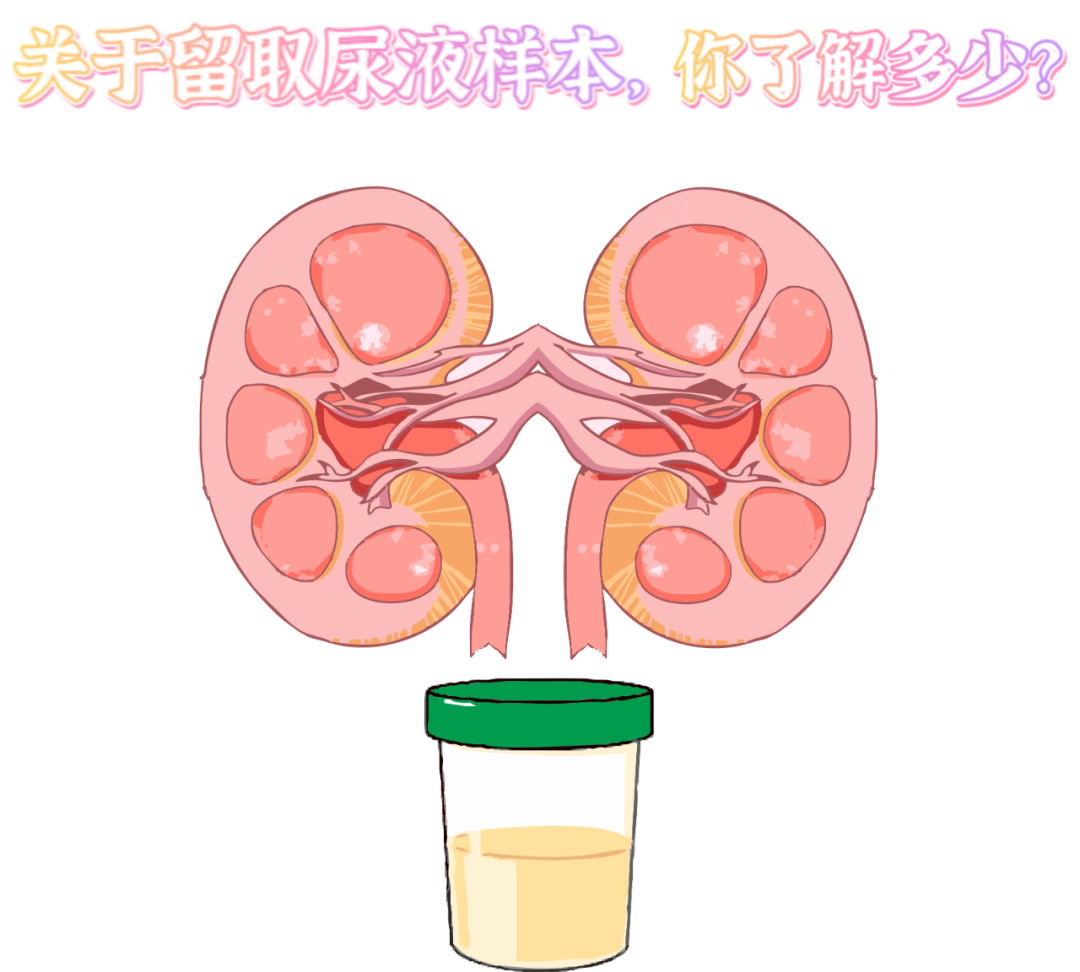 做尿檢，不得不說的注意事項！