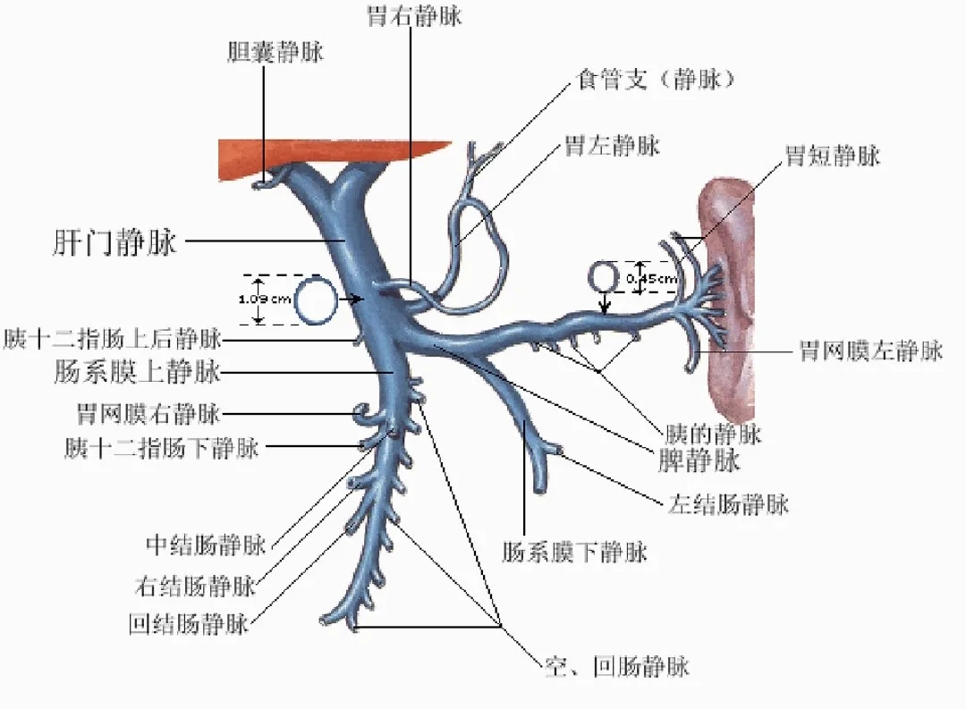 反復嘔血、黑便怎么辦？TIPS手術(shù)能解決