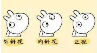 小baby老歪著頭？警惕斜頸! 這樣糾正……