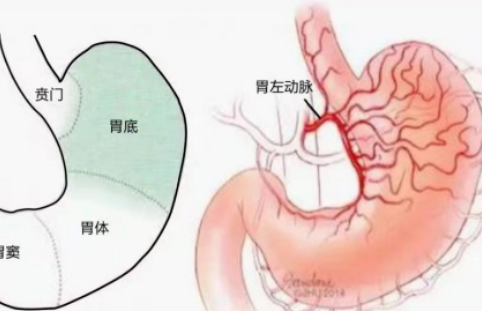 不開刀不吃藥不餓肚子，微創(chuàng)介入減肥靠譜嗎？