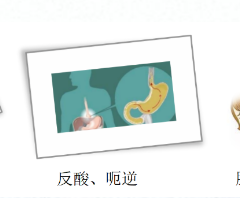 關(guān)愛身體健康，輕松檢查胃腸