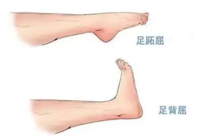 扭胯小連步、動感搖花手……“科目三”雖火，運(yùn)動損傷也要防！
